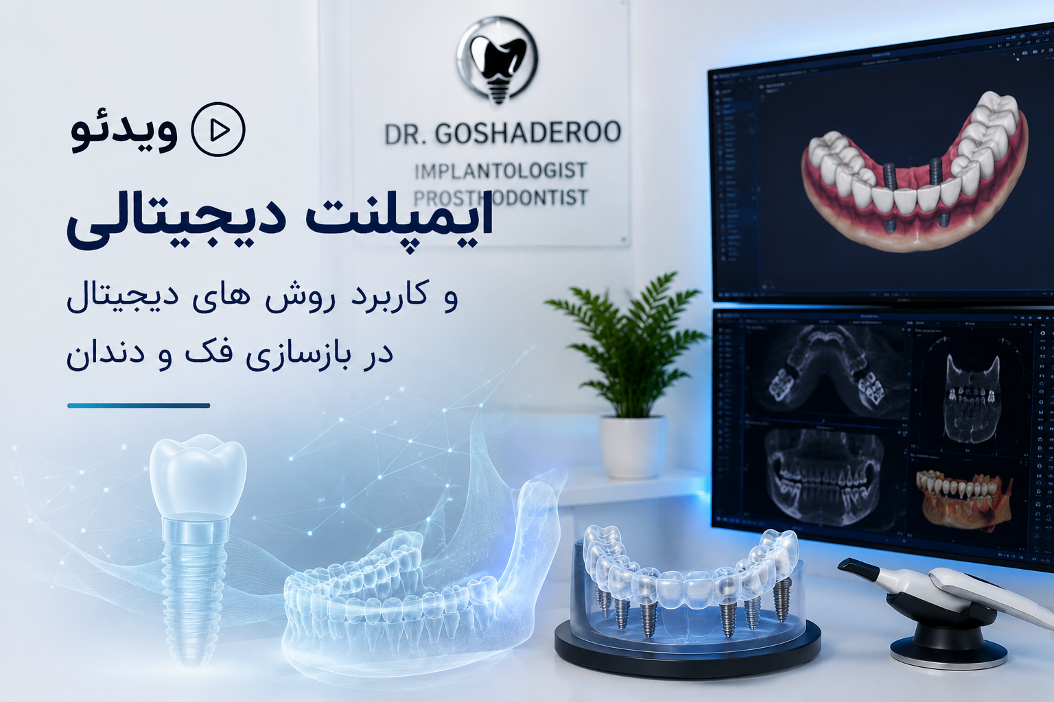 ویدئو ایمپلنت دیجیتالی و کاربرد روش های دیجیتال در بازسازی فک و دندان